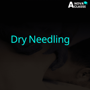 Dry Needling